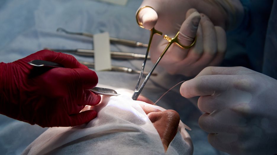 Chirurgie dentaire