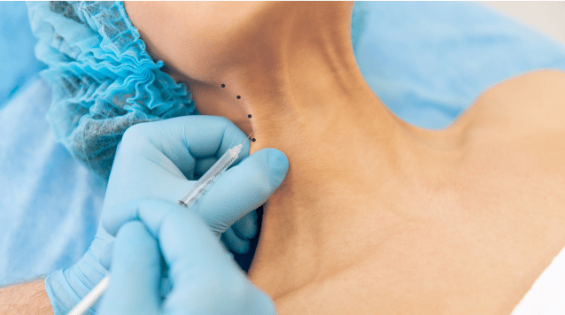 Neuromodulateurs niveau 3 Neuromodulateurs niveau 3